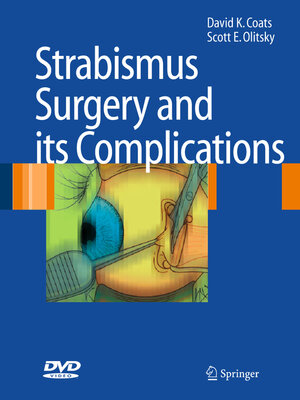 cover image of Strabismus Surgery and its Complications